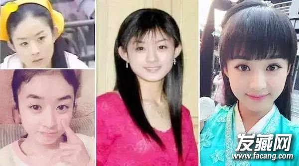 发际线后移影响颜值,从护发着手该怎么做? 发际线后移影响颜值,从护发着手该怎么做? 发际线高怎么办