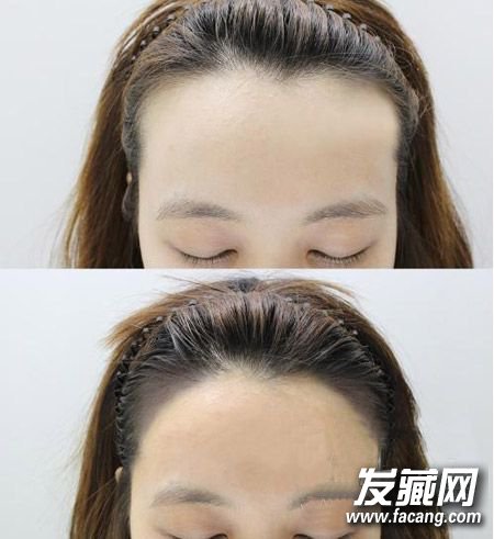 颜值不够发际线也要美过别人 2招拥有“美人线” 颜值不够发际线也要美过别人 2招拥有“美人线” 古力娜扎 发际线